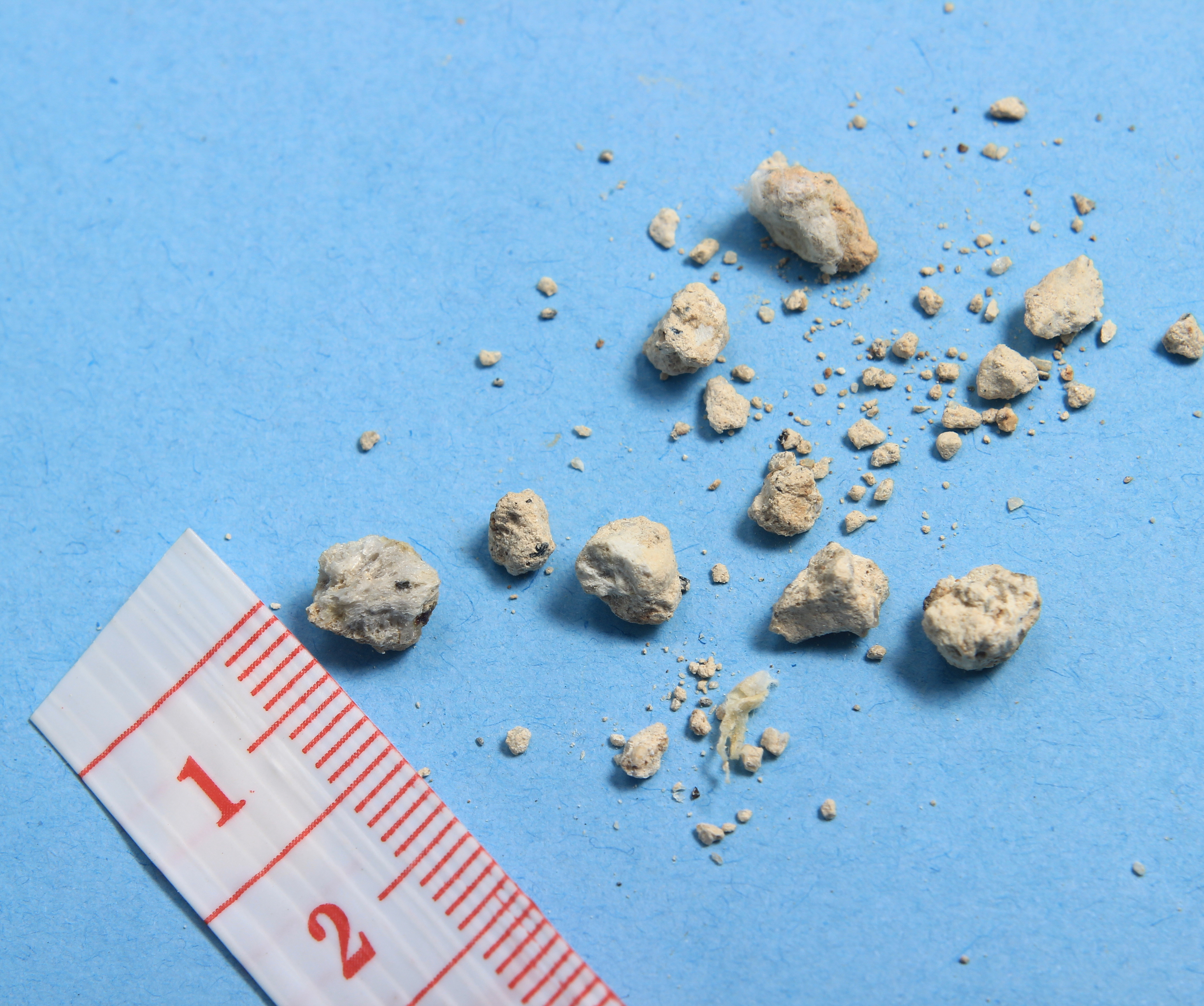 Harnsteine liegen neben einem Maßband. Harnsteine im Urin sind meist nur wenige Millimeter groß.