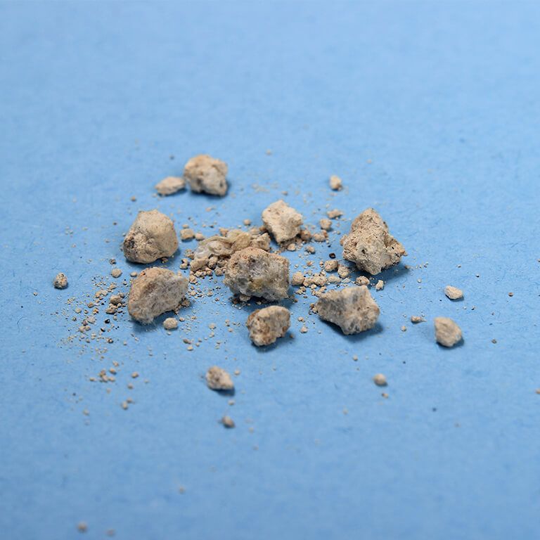 Harnsteine liegen neben einem Maßband. Harnsteine im Urin sind meist nur wenige Millimeter groß.